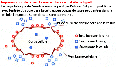diabete-type2
