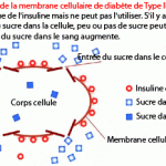 diabete-type2